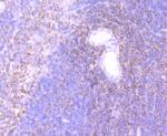 ELMO1 Recombinant Rabbit Monoclonal Antibody (JG34-59)