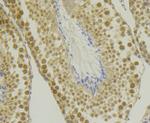 CHD1L Antibody in Immunohistochemistry (Paraffin) (IHC (P))
