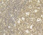 CHD1L Antibody in Immunohistochemistry (Paraffin) (IHC (P))