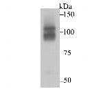 CHD1L Antibody in Western Blot (WB)