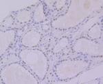 HnRNP Q Antibody in Immunohistochemistry (Paraffin) (IHC (P))