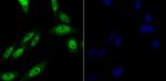 PRP8 Recombinant Rabbit Monoclonal Antibody (JG57-38)
