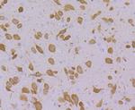 FBXO5 Antibody in Immunohistochemistry (Paraffin) (IHC (P))