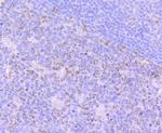 FBXO5 Antibody in Immunohistochemistry (Paraffin) (IHC (P))