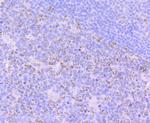 FBXO5 Antibody in Immunohistochemistry (Paraffin) (IHC (P))