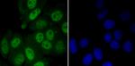 MYST1 Antibody in Immunocytochemistry (ICC/IF)