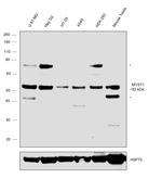 MYST1 Antibody in Western Blot (WB)