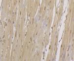 CENPC Antibody in Immunohistochemistry (Paraffin) (IHC (P))