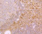 IRAK2 Antibody in Immunohistochemistry (Paraffin) (IHC (P))