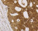 IRAK2 Antibody in Immunohistochemistry (Paraffin) (IHC (P))
