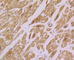 IRAK2 Antibody in Immunohistochemistry (Paraffin) (IHC (P))