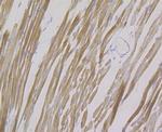 FHL2 Antibody in Immunohistochemistry (Paraffin) (IHC (P))