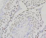 SUV39H2 Recombinant Rabbit Monoclonal Antibody (JG36-55)