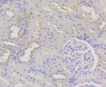 WNK1 Antibody in Immunohistochemistry (Paraffin) (IHC (P))