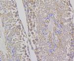 WNK1 Antibody in Immunohistochemistry (Paraffin) (IHC (P))