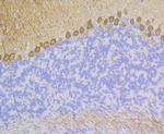 PKC gamma Recombinant Rabbit Monoclonal Antibody (JG69-32)