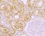 MIB1 Antibody in Immunohistochemistry (Paraffin) (IHC (P))