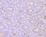 MIB1 Antibody in Immunohistochemistry (Paraffin) (IHC (P))