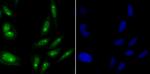 ILF3 Antibody in Immunocytochemistry (ICC/IF)