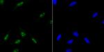 ILF3 Recombinant Rabbit Monoclonal Antibody (JG37-63)