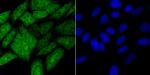 HIF1AN Recombinant Rabbit Monoclonal Antibody (JG37-66)