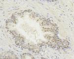 HIF1AN Antibody in Immunohistochemistry (Paraffin) (IHC (P))