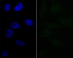 LPIN1 Recombinant Rabbit Monoclonal Antibody (JG37-69)