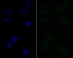 LPIN1 Antibody in Immunocytochemistry (ICC/IF)