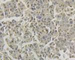 LPIN1 Antibody in Immunohistochemistry (Paraffin) (IHC (P))