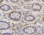 LPIN1 Antibody in Immunohistochemistry (Paraffin) (IHC (P))