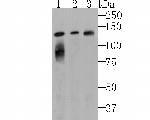 LPIN1 Antibody in Western Blot (WB)