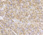 P2Y6 Antibody in Immunohistochemistry (Paraffin) (IHC (P))