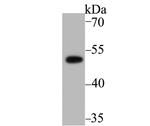 PICK1 Recombinant Rabbit Monoclonal Antibody (JG30-80)