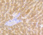 Alcohol Dehydrogenase 1A Antibody in Immunohistochemistry (Paraffin) (IHC (P))