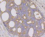 NDUFA13 Antibody in Immunohistochemistry (Paraffin) (IHC (P))