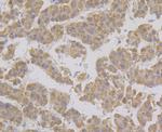 NDUFA13 Antibody in Immunohistochemistry (Paraffin) (IHC (P))