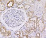 NDUFA13 Antibody in Immunohistochemistry (Paraffin) (IHC (P))