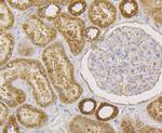 UPF1 Antibody in Immunohistochemistry (Paraffin) (IHC (P))