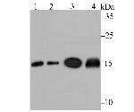 UBC13 Recombinant Rabbit Monoclonal Antibody (JG38-68)