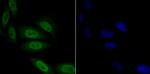 TNPO3 Antibody in Immunocytochemistry (ICC/IF)