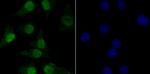 TNPO3 Recombinant Rabbit Monoclonal Antibody (JG38-77)