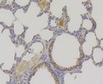 TNPO3 Antibody in Immunohistochemistry (Paraffin) (IHC (P))