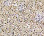 TNPO3 Antibody in Immunohistochemistry (Paraffin) (IHC (P))