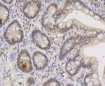 TNPO3 Antibody in Immunohistochemistry (Paraffin) (IHC (P))