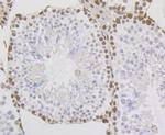 NONO Antibody in Immunohistochemistry (Paraffin) (IHC (P))