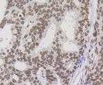NONO Antibody in Immunohistochemistry (Paraffin) (IHC (P))