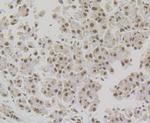 NONO Antibody in Immunohistochemistry (Paraffin) (IHC (P))