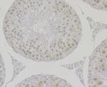 Bub3 Antibody in Immunohistochemistry (Paraffin) (IHC (P))