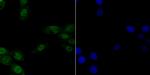 CAF1 p150 Recombinant Rabbit Monoclonal Antibody (JG38-98)