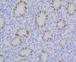CAF1 p60 Recombinant Rabbit Monoclonal Antibody (JG92-30)